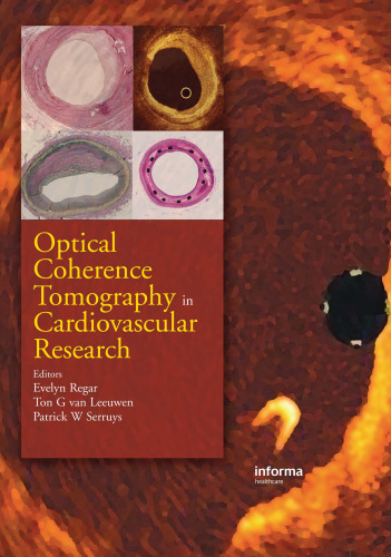 Optical Coherence Tomography in Cardiovascular Research