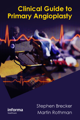 Clinical Guide to Primary Angioplasty