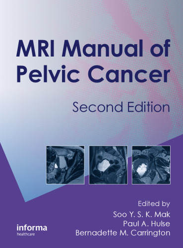 MRI Manual of Pelvic Cancer, Second Edition