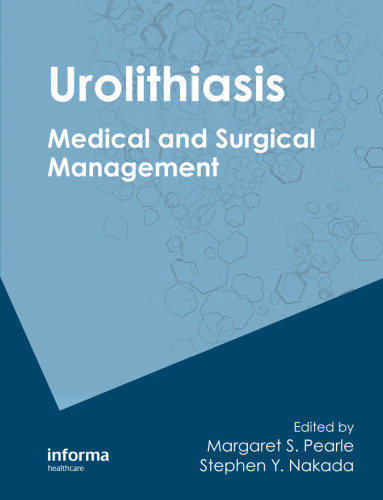 Urolithiasis: Medical and Surgical Management of Stone Disease