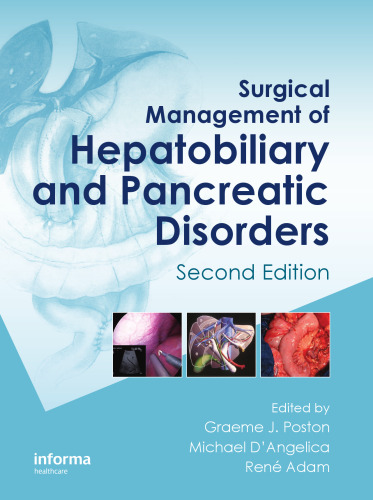 Surgical Management of Hepatobiliary and Pancreatic Disorders, Second Edition (Oncologysurgery)