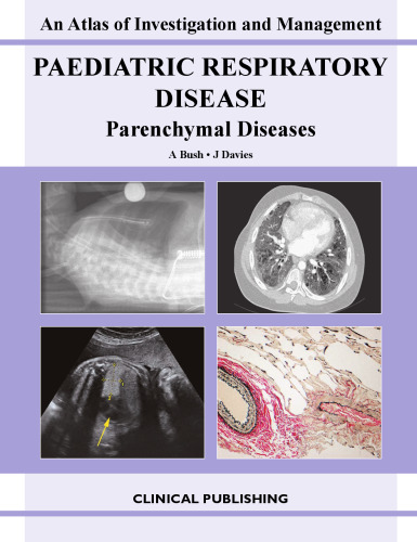 Paediatric Respiratory Disease: Parenchymal Diseases