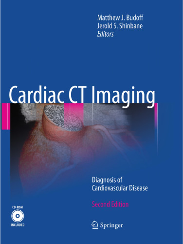 Cardiac CT Imaging: Diagnosis of Cardiovascular Disease