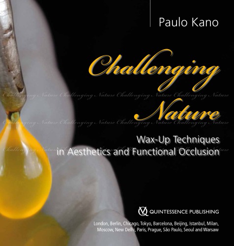 Challenging Nature: Wax-up Techniques in Aesthetics and Functional Occlusion
