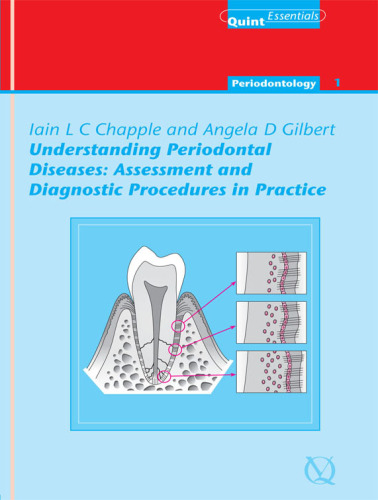 Understanding Periodontal Diseases: QuintEssentials of Dental Practice Vol. 1