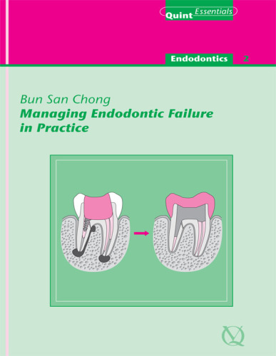 Managing Endodontic Failure in Practice: QuintEssentials of Dental Practice Vol. 23