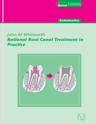 Rational Root Canal Treatment in Practice: QuintEssentials of Dental Practice Vol. 2