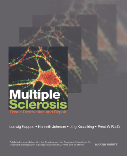 Multiple sclerosis : tissue destruction and repair
