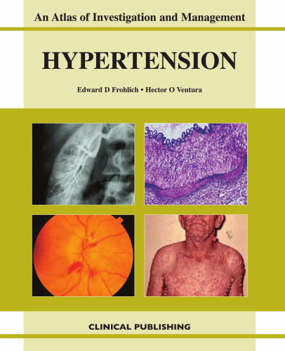 Hypertension: An Atlas of Investigation and Management