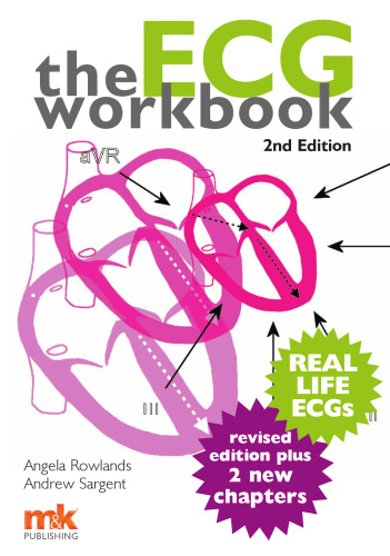 The Ecg Workbook