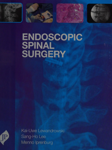 Endoscopic Spinal Surgery