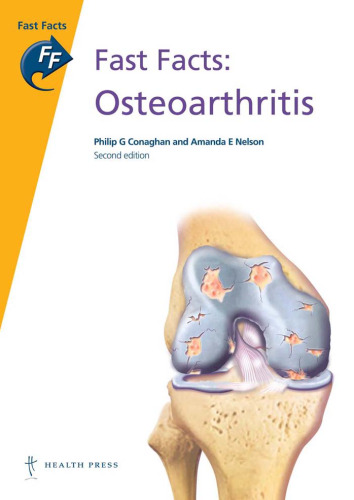 Fat Facts: Osteoarthritis, second edition (Fast Facts)