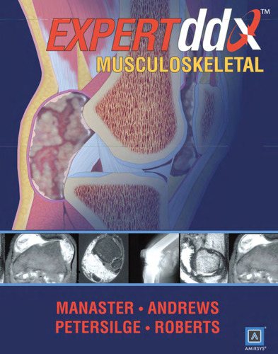 EXPERTddx : Musculoskeletal