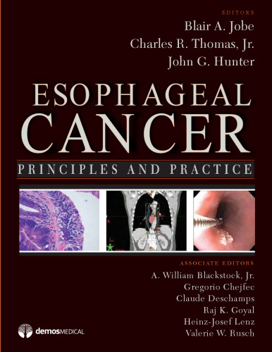 Esophageal Cancer: Principles and Practice