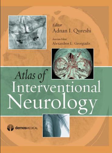 Atlas of Interventional Neurology