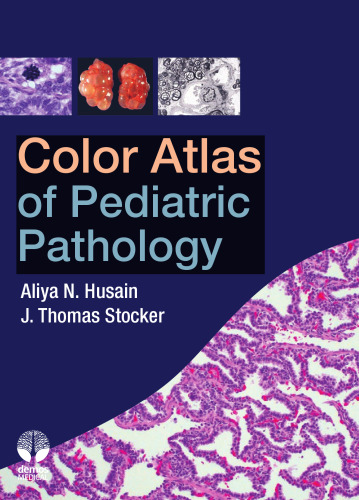 Color Atlas of Pediatric Pathology