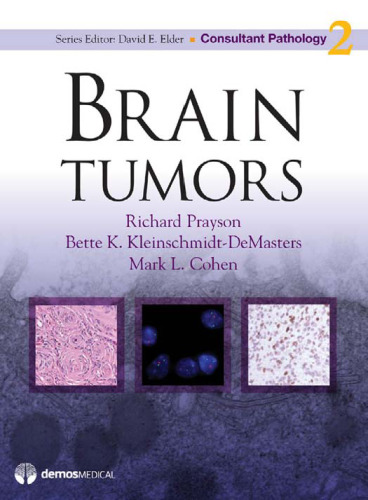 Brain Tumors