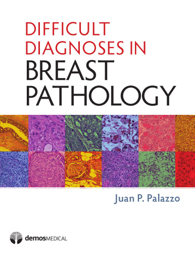 Difficult Diagnoses in Breast Pathology
