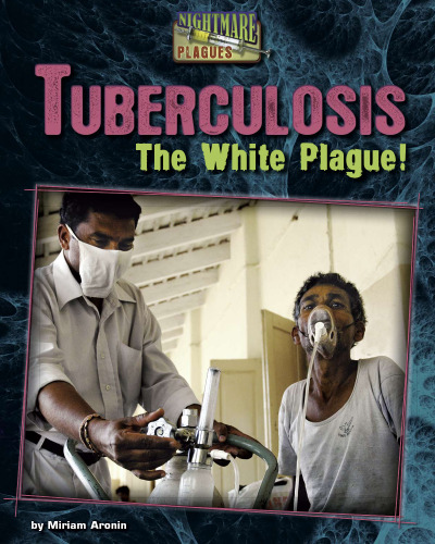 Tuberculosis: The White Plague!