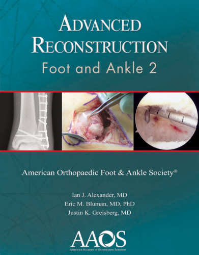 Advanced Reconstruction: Foot and Ankle 2: Print + Ebook
