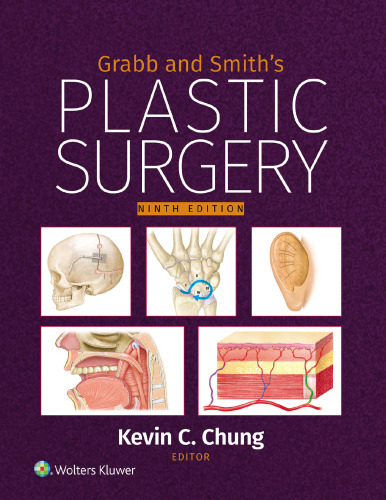 Grabb and Smith's Plastic Surgery