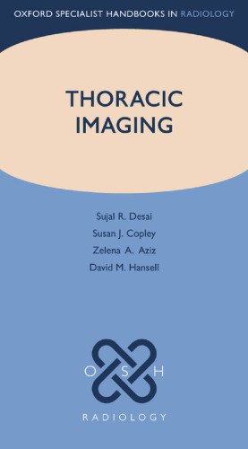 Thoracic Imaging (Oxford Specialist Handbooks in Radiology)