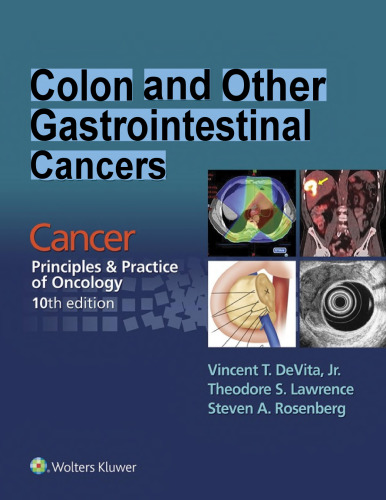 Colon and Other Gastrointestinal Cancers - Cancer - Principles & Practice of Oncology, 10e (May 26, 2016)_(1496333969)_(LWW)
