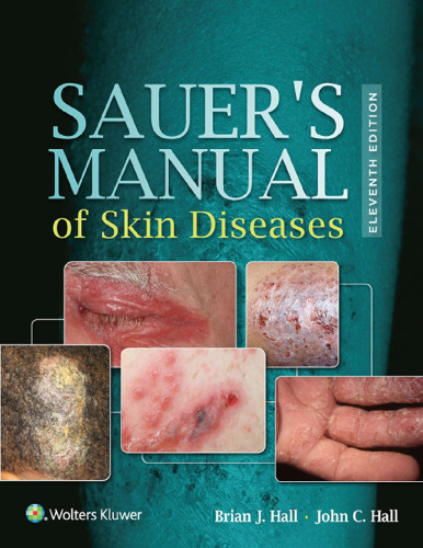 Sauer's Manual of Skin Diseases, 11e (May 5, 2017)_(1496329937)_(LWW)