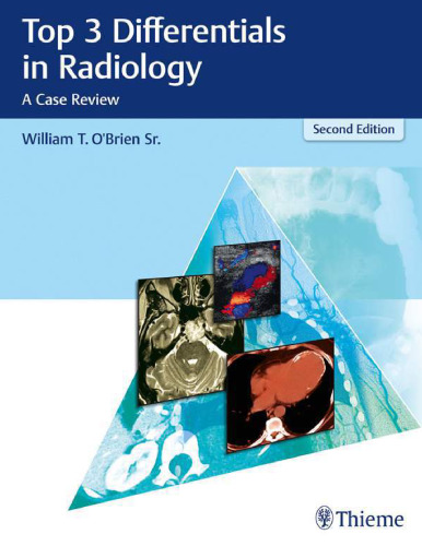 Top 3 differentials in radiology : a case review