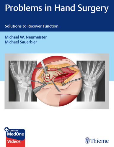 Problems in Hand Surgery. Solutions to Recover Function