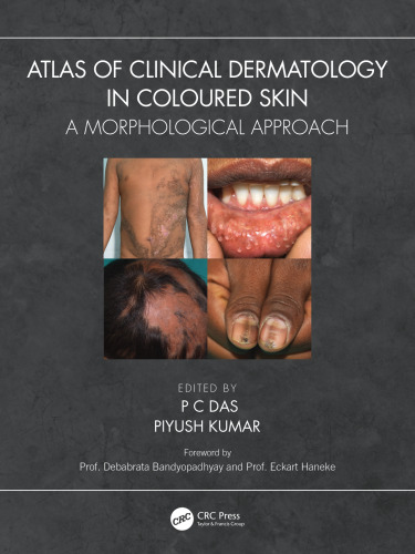Atlas of Clinical Dermatology in Coloured Skin: A Morphological Approach