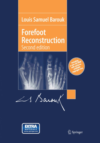 Forefoot Reconstruction