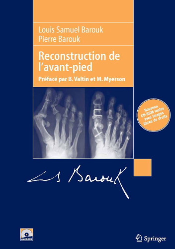 Reconstruction de l'avant-pied