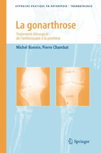 La gonarthrose : Traitement chirurgical : de l'arthroscopie à la prothèse