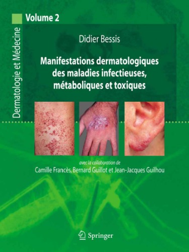 Manifestations dermatologiques et maladies infectieuses, métaboliques et toxiques.