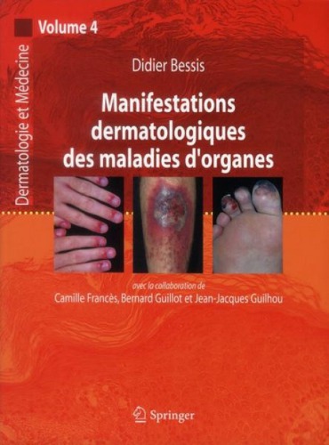 Manifestations dermatologiques des maladies d'organes, volume 4
