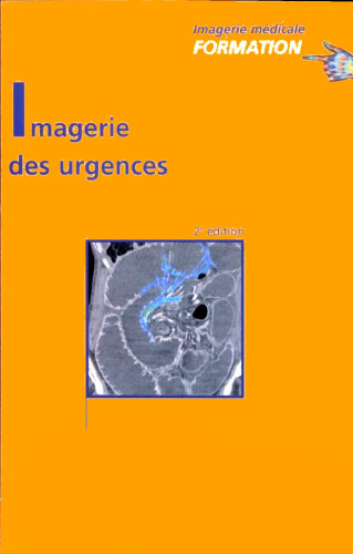 Imagerie des urgences: JFR 2004 (Imagerie médicale : formation)