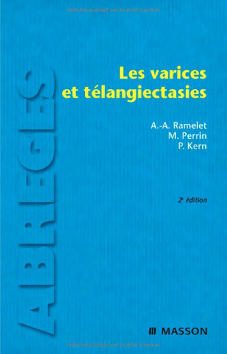 Les varices et télangiectasies