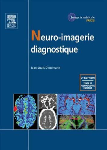 Neuro-imagerie diagnostique