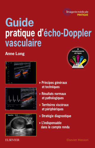 Guide pratique d'écho-Doppler vasculaire