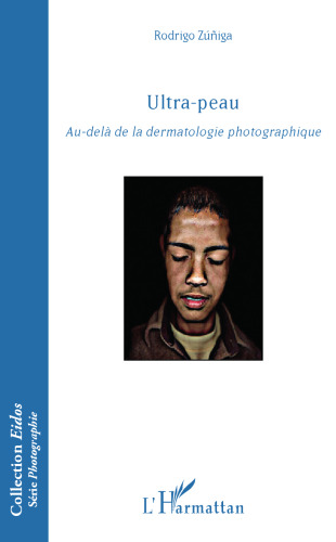 Ultra-peau: au-delà de la dermatologie photographique