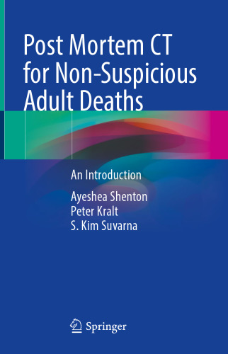 Post Mortem CT for Non-Suspicious Adult Deaths: An Introduction