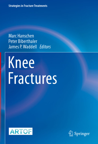 Knee Fractures (Strategies in Fracture Treatments)