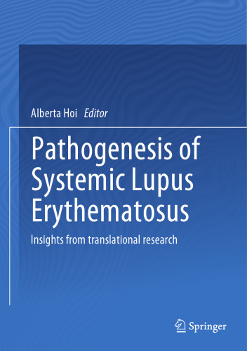 Pathogenesis of Systemic Lupus Erythematosus: Insights from Translational Research