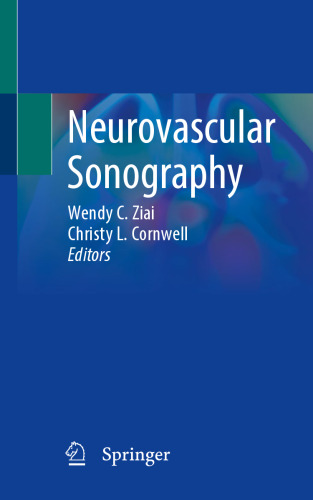 Neurovascular Sonography
