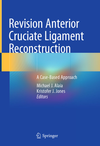 Revision Anterior Cruciate Ligament Reconstruction: A Case-Based Approach