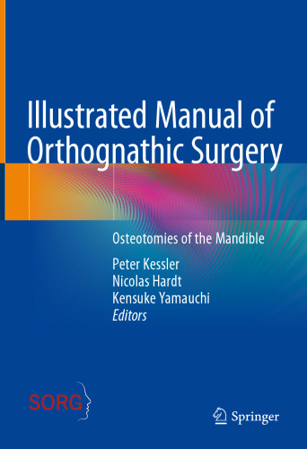 Illustrated Manual of Orthognathic Surgery: Osteotomies of the Mandible