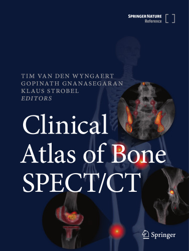 Clinical Atlas of Bone SPECT/CT
