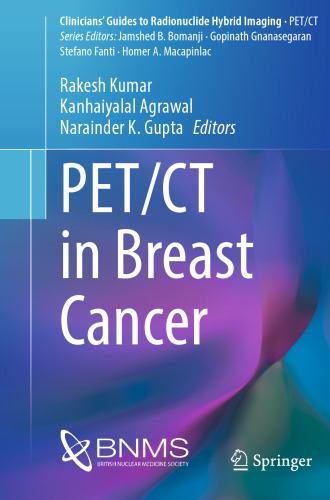 PET/CT in Breast Cancer (Clinicians’ Guides to Radionuclide Hybrid Imaging)