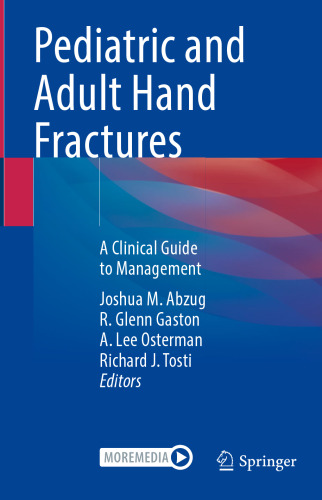 Pediatric and Adult Hand Fractures: A Clinical Guide to Management